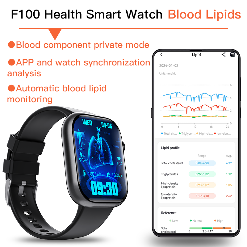 Best ECG Smart Watch of 2026 With Blood Pressure Monitor